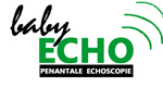 Baby Echo Son Baby Echo Son